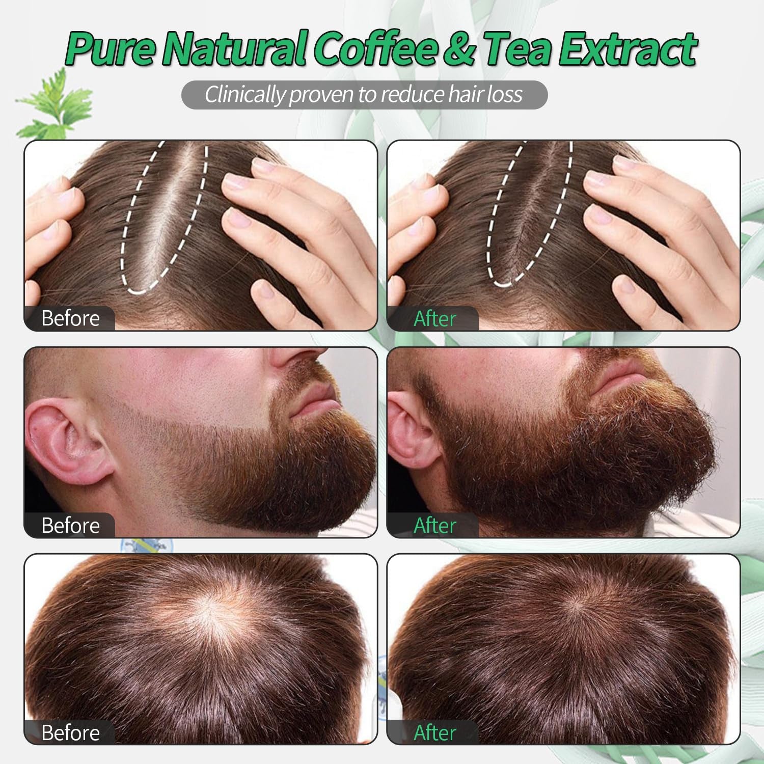 Hair Growth Serum Roll on Rosemary Hair Serum for Hair Loss Thinning Hair